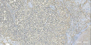 EPRS1/PARS Mouse Monoclonal Antibody