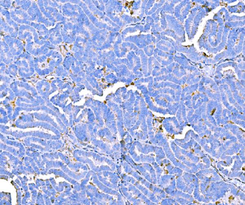Prothrombin Antibody (monoclonal, 4G13G9)
