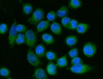 FACL4/ACSL4 Antibody (monoclonal, 4I7)