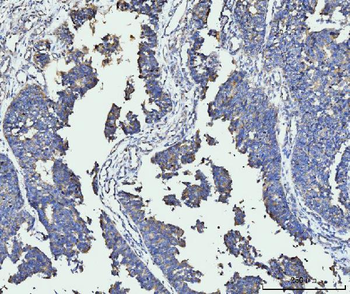 FACL4/ACSL4 Antibody (monoclonal, 4I7)