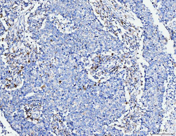 FACL4/ACSL4 Antibody (monoclonal, 4I7)