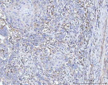 FACL4/ACSL4 Antibody (monoclonal, 4I7)
