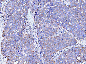 FACL4/ACSL4 Antibody (monoclonal, 4I7)