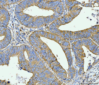 FACL4/ACSL4 Antibody (monoclonal, 4I7)
