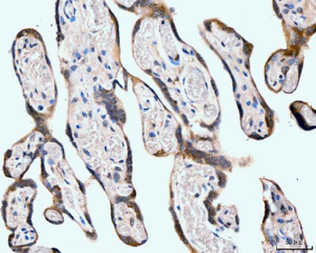 Neurofibromin/NF1 Antibody (monoclonal, 4C6F10)