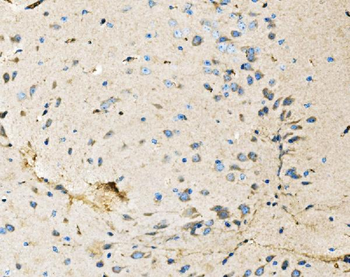 Neurofibromin/NF1 Antibody (monoclonal, 4C6F10)