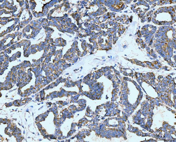 Neurofibromin/NF1 Antibody (monoclonal, 4F8B7)