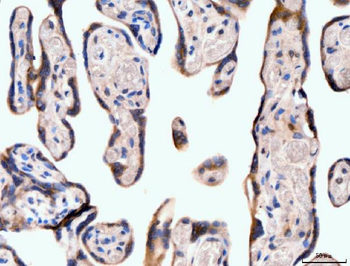 Neurofibromin/NF1 Antibody (monoclonal, 4F8B7)
