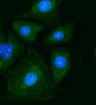 PKM2 Antibody (monoclonal, 11I4C3)