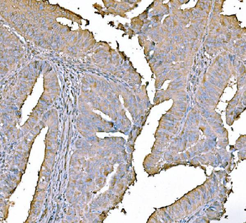 PKM2 Antibody (monoclonal, 11I4C3)