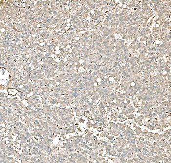 PKM2 Antibody (monoclonal, 11I4C3)