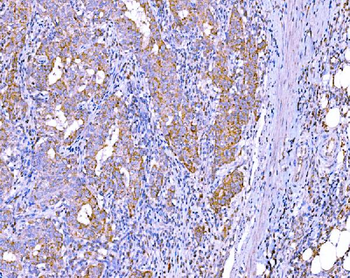 RALBP1 Antibody (monoclonal, 2F9D3)