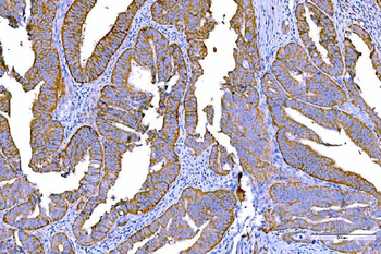 RALBP1 Antibody (monoclonal, 2F9D3)