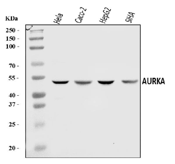 Aurora A/AURKA Rabbit Polyclonal Antibody