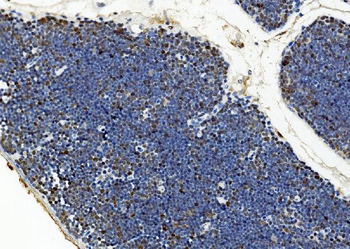 BUB1 Rabbit Polyclonal Antibody