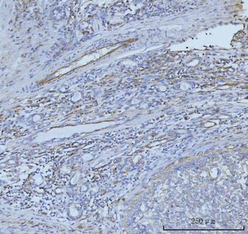 CD93 Antibody