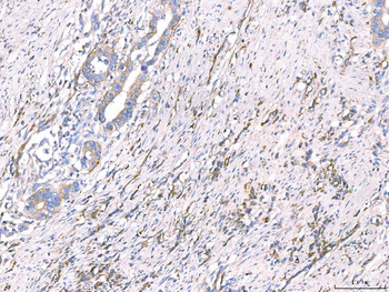 CD93 Antibody