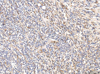 CD93 Antibody