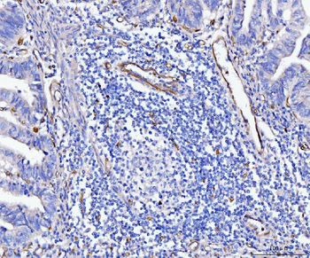 CD93 Antibody