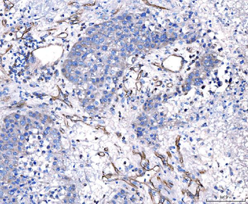 CD93 Antibody