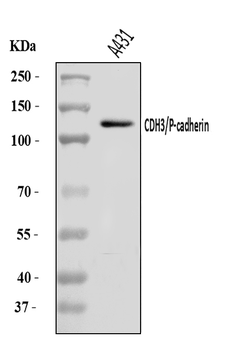 P cadherin/CDH3 Rabbit Polyclonal Antibody