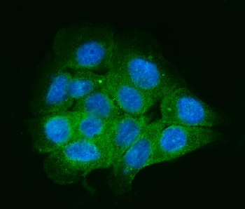 ENAH/MENA Rabbit Polyclonal Antibody