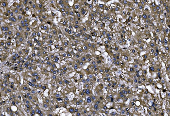 ENAH/MENA Rabbit Polyclonal Antibody