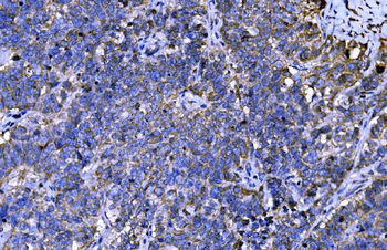 ENAH/MENA Rabbit Polyclonal Antibody