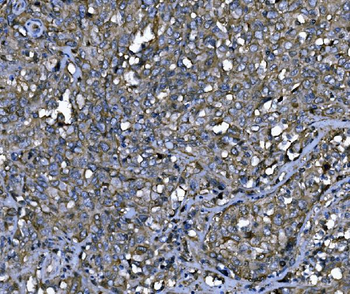 ENAH/MENA Rabbit Polyclonal Antibody