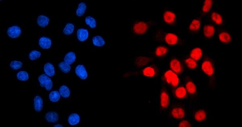 GATA6 Rabbit Polyclonal Antibody