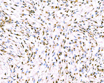 Giantin/GOLGB1 Antibody