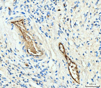 Hemoglobin/HBA1/HBA2 Rabbit Polyclonal Antibody