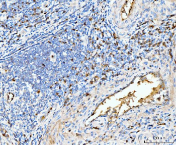 Hemoglobin/HBA1/HBA2 Rabbit Polyclonal Antibody