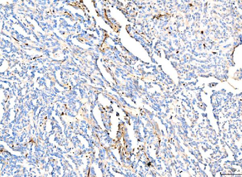 Hemoglobin/HBA1/HBA2 Rabbit Polyclonal Antibody