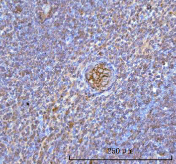 Hemoglobin/HBA1/HBA2 Rabbit Polyclonal Antibody