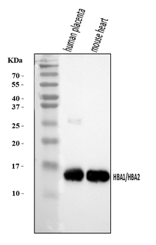 Hemoglobin/HBA1/HBA2 Rabbit Polyclonal Antibody