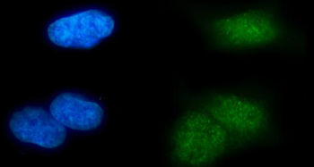 MSL2 Rabbit Polyclonal Antibody