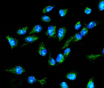 MTHFD1L Rabbit Polyclonal Antibody