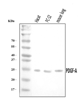PDGF AA/PDGFA Rabbit Polyclonal Antibody