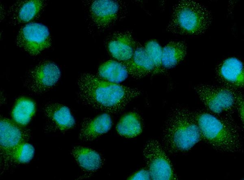 PDP1/PDP Rabbit Polyclonal Antibody