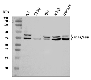 PDP1/PDP Rabbit Polyclonal Antibody