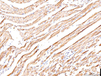 Phospholamban/PLN Antibody