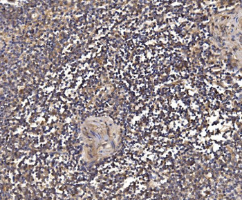 PSMD8 Antibody