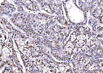 PSMD8 Antibody