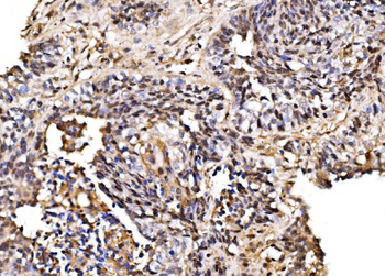 PSMD8 Antibody