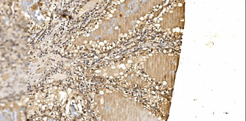 PSMD8 Antibody