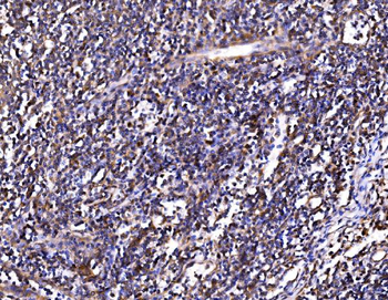 PSMD8 Antibody