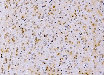 PSMD8 Antibody