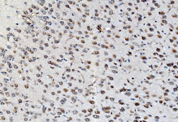 PSMD8 Antibody