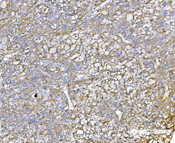 Poliovirus Receptor/PVR Rabbit Polyclonal Antibody